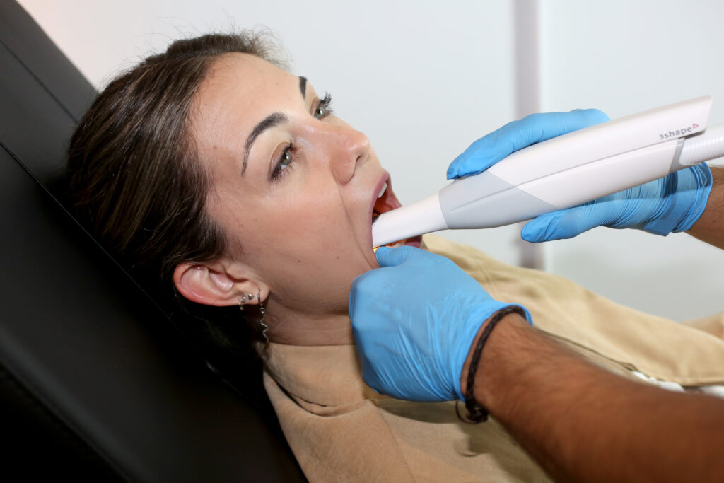 Escáner intraoral