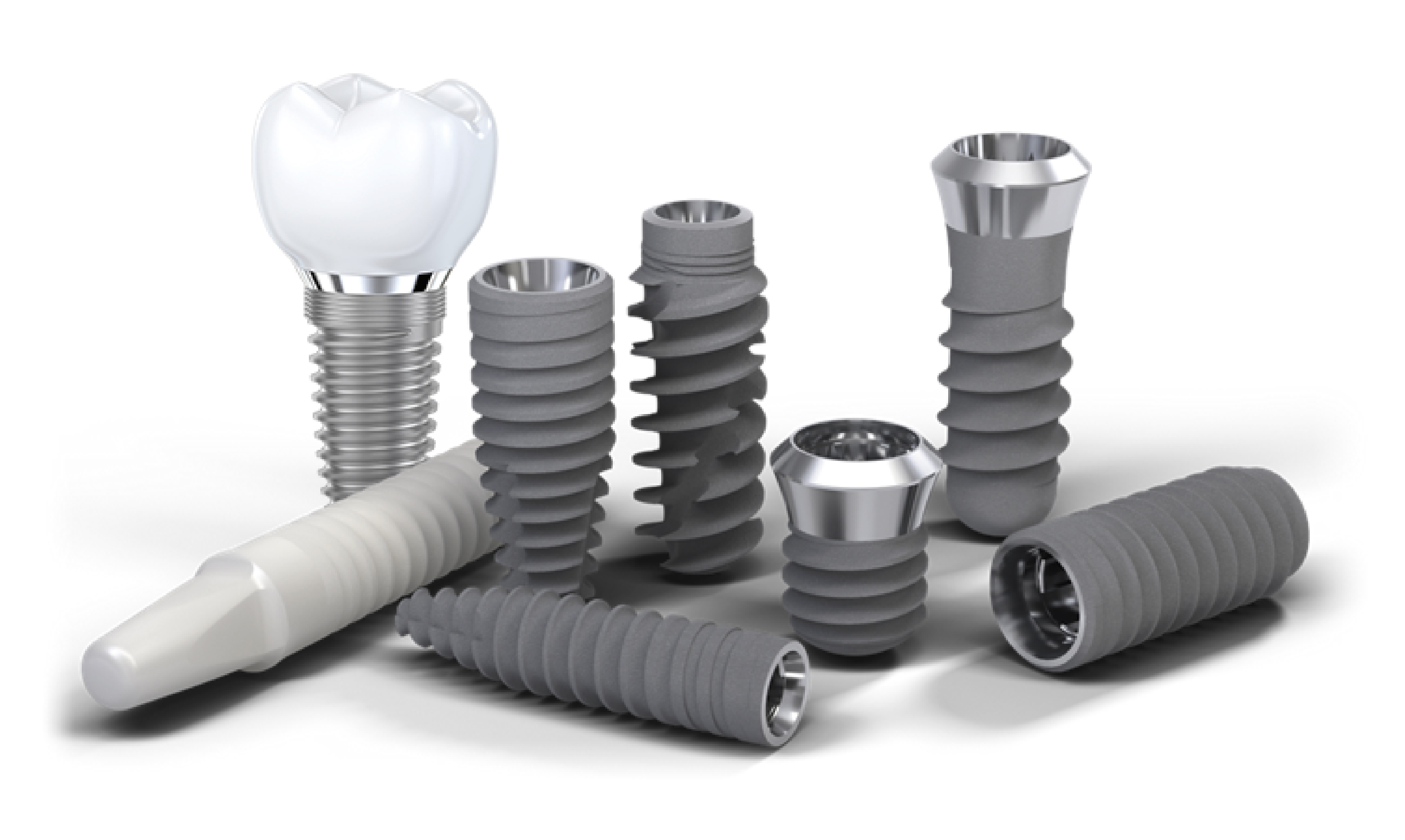 Implante dental y corona