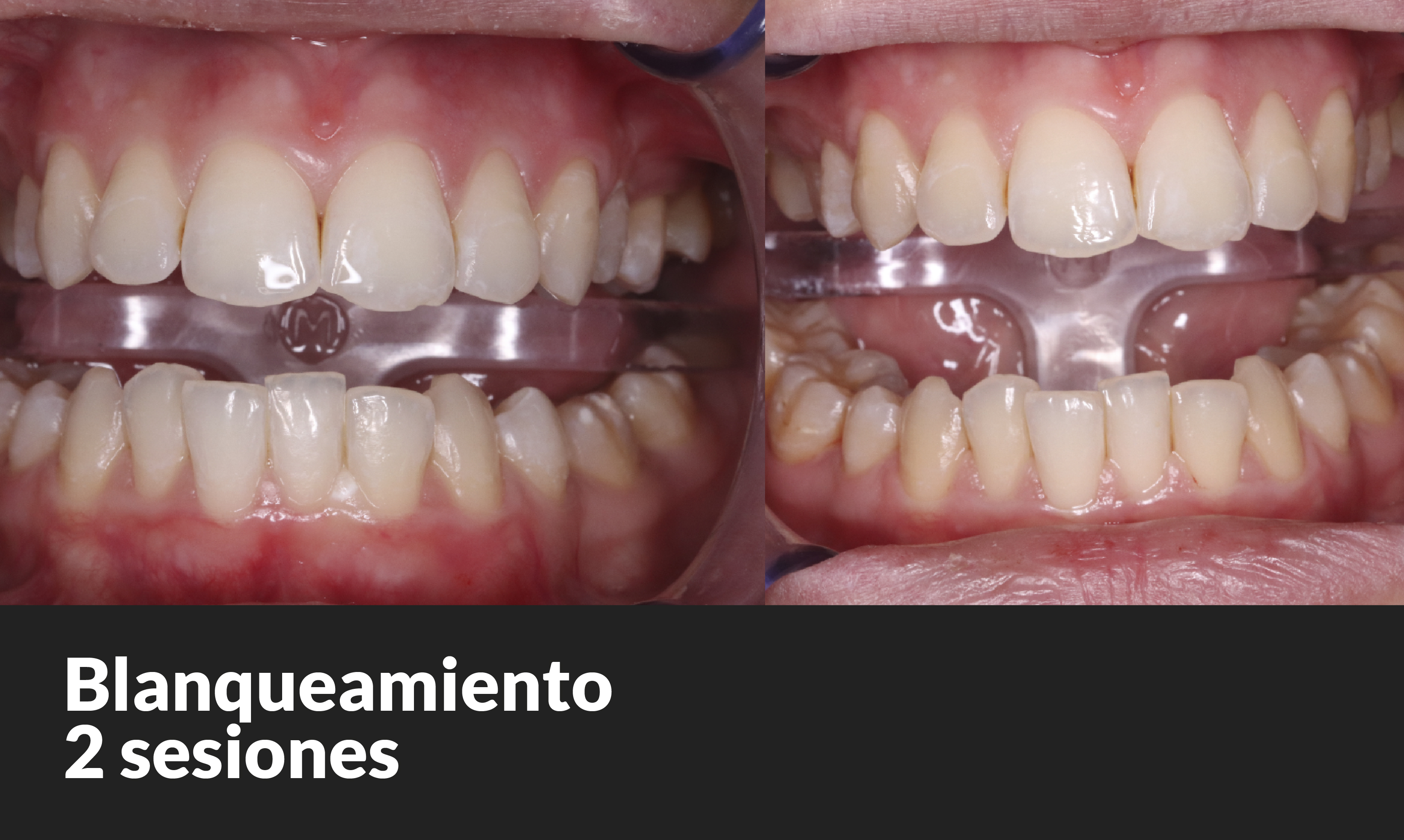 ¿CÓMO TENER UNA SONRISA PERFECTA?