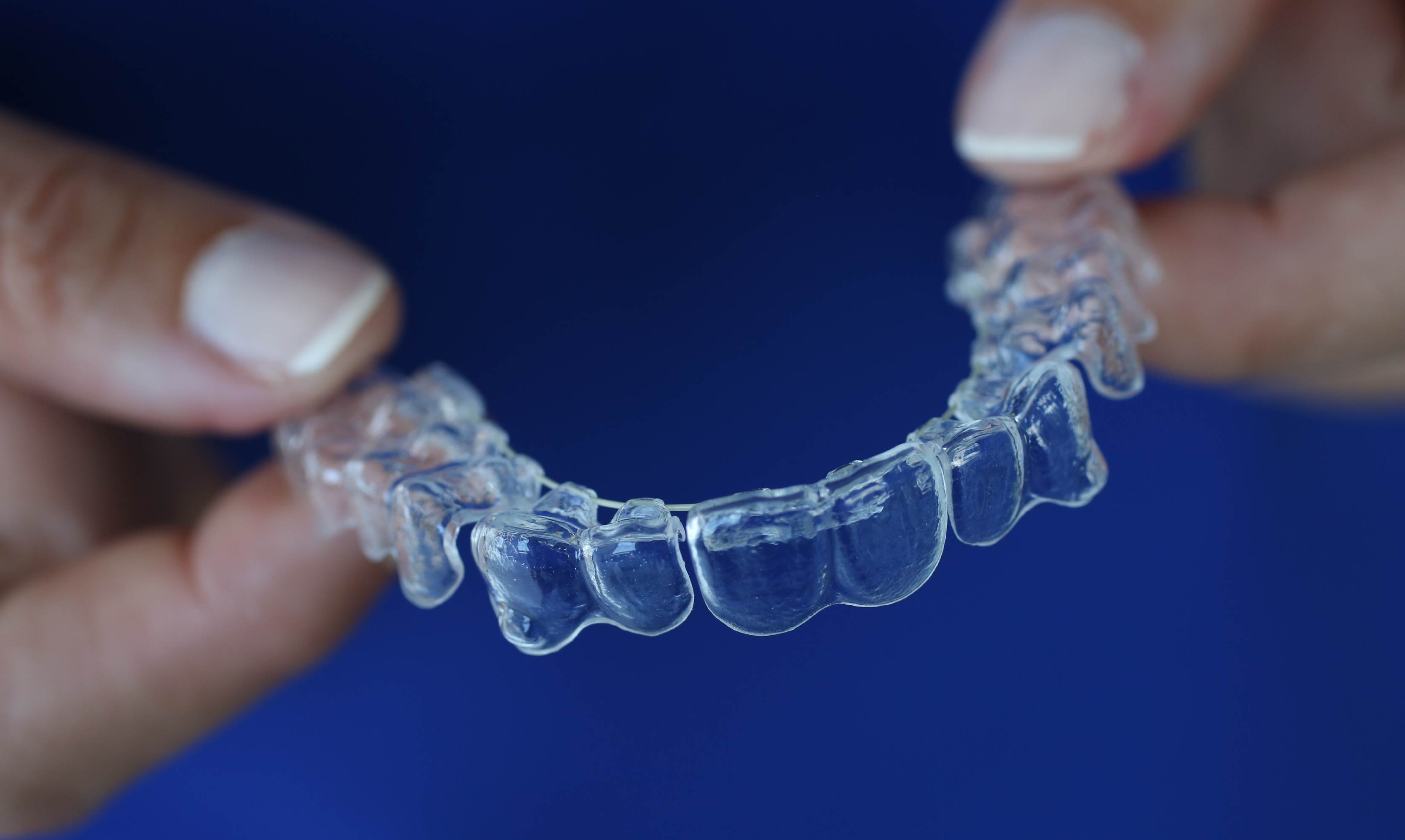 Cómo poner y quitar correctamente la ortodoncia invisible