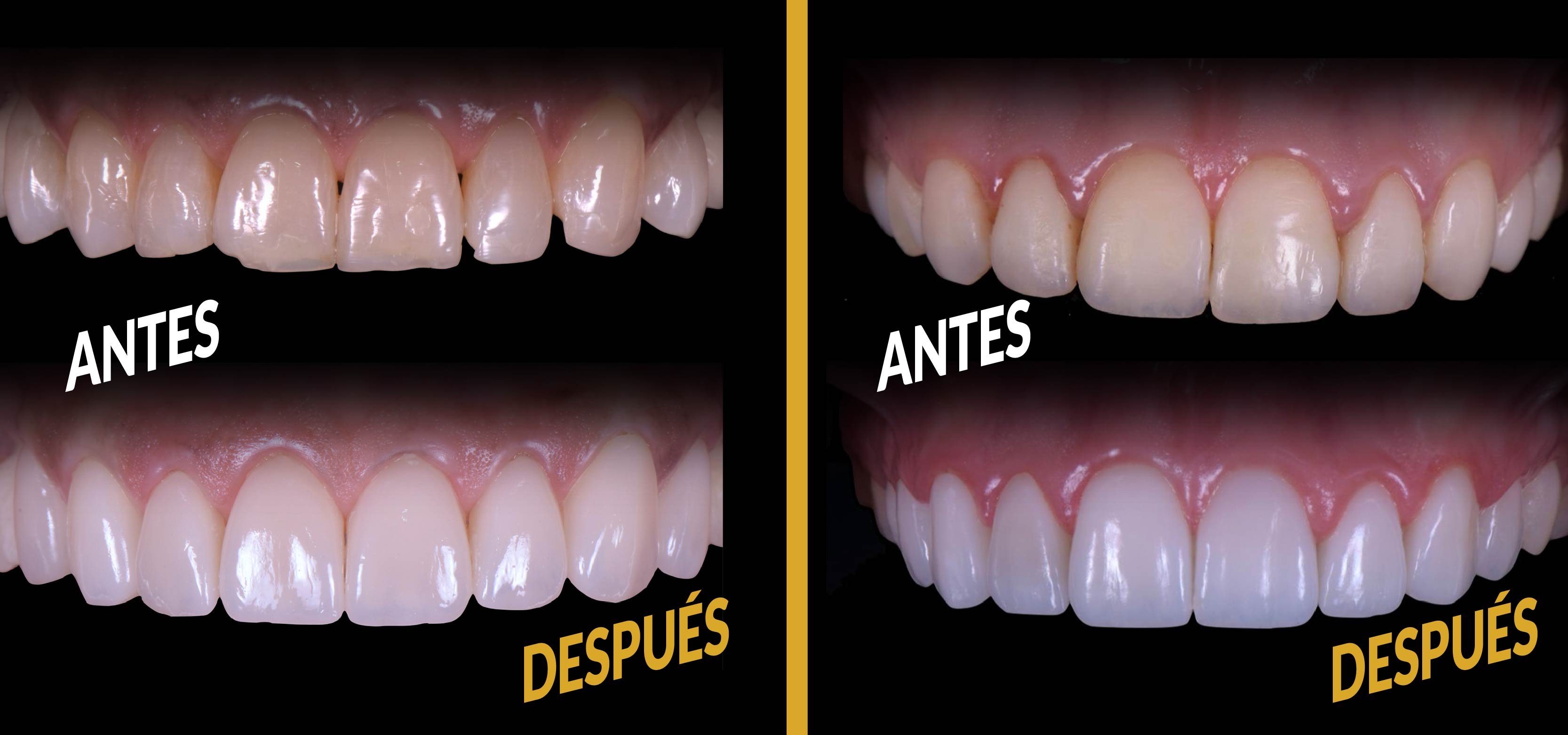 CARILLAS ANTES Y DESUPUES