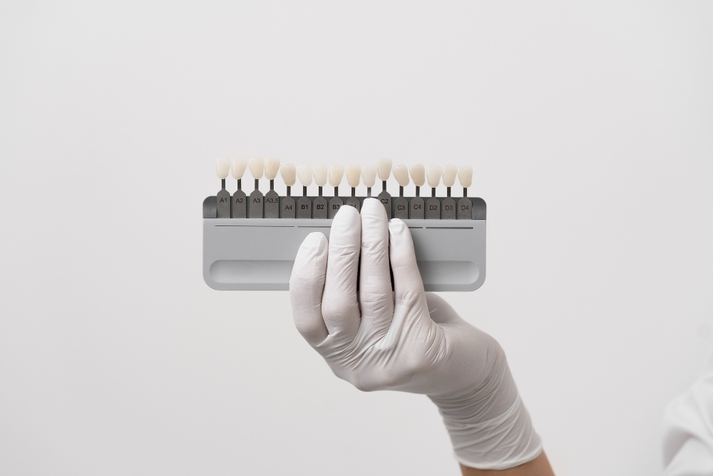 cuánto duran las carillas de composite
