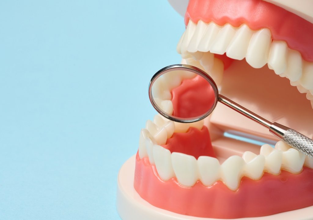 maloclusión dental