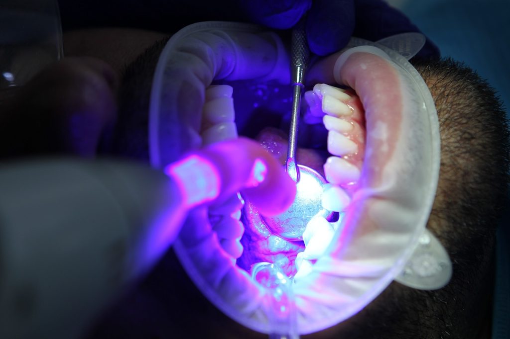 cómo se hace un blanqueamiento dental