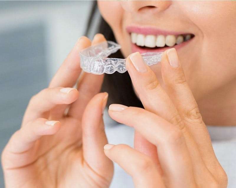 que es mejor brackets o alineadores invisibles